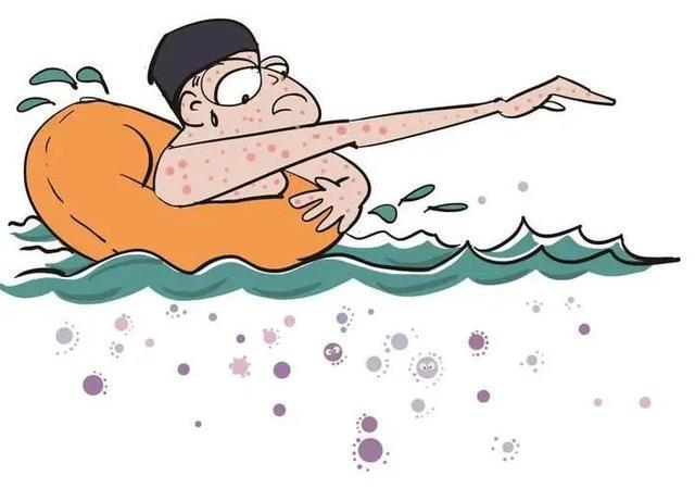 1751876499604665.jpeg 游泳池細(xì)菌2.jpeg